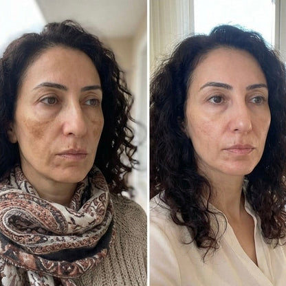 Zerdeçal İçeren Nazik Peeling Pedleri  & Cildiniz Parlasın