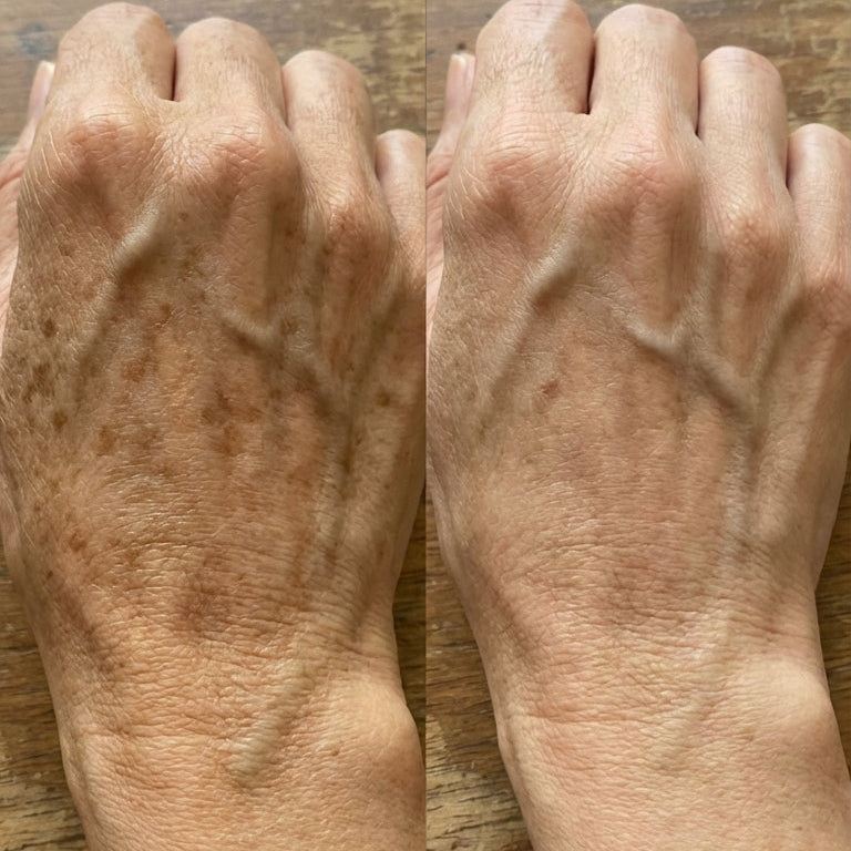 Zerdeçal İçeren Nazik Peeling Pedleri  & Cildiniz Parlasın